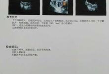 深圳宫外孕爆料新闻报道